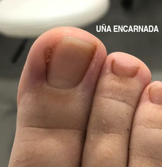 Policlínica Pablo Casado, especialistas en Podología General en Murcia